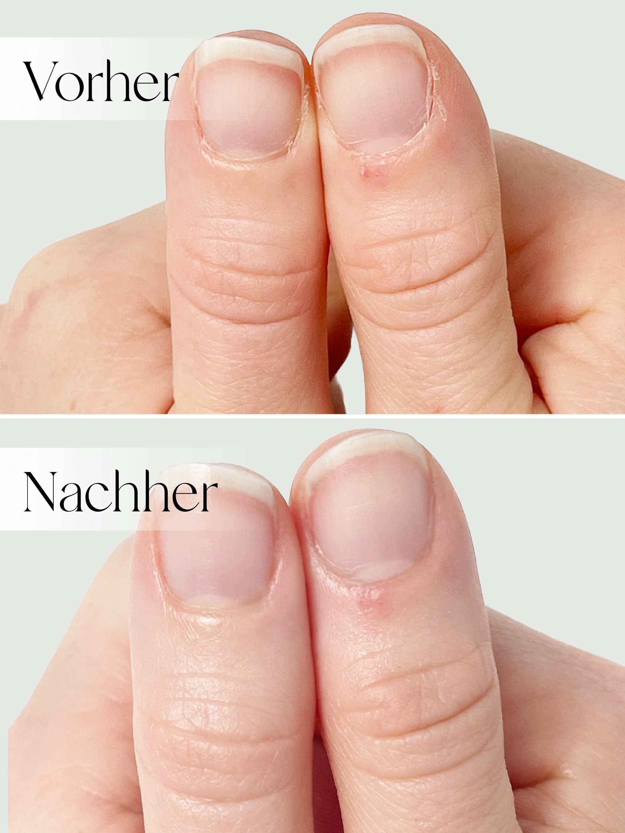 Anti-Flecken Handmaske - Image 3