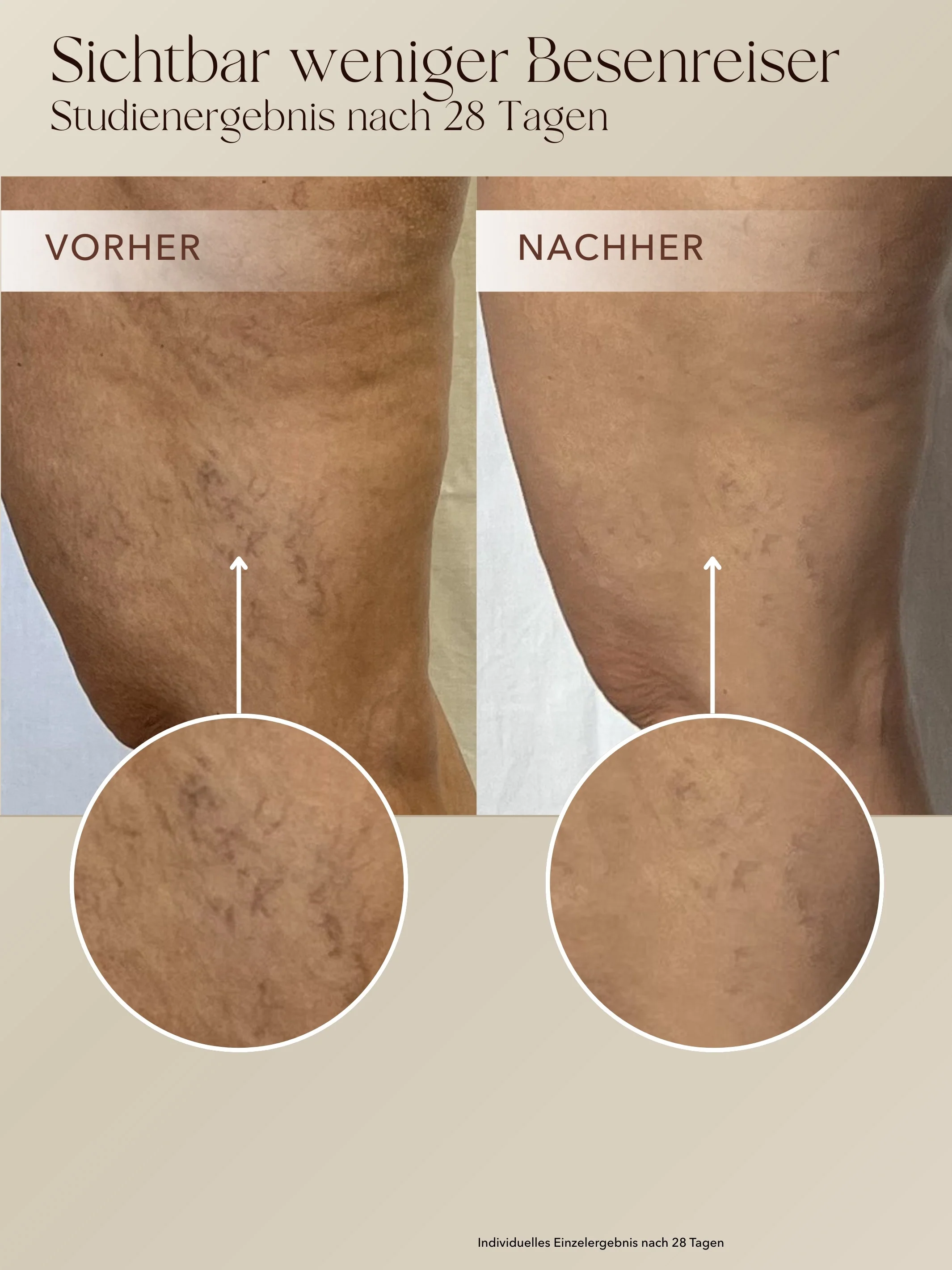 Anti-Cellulite 3-Monats-Kur - Image 4