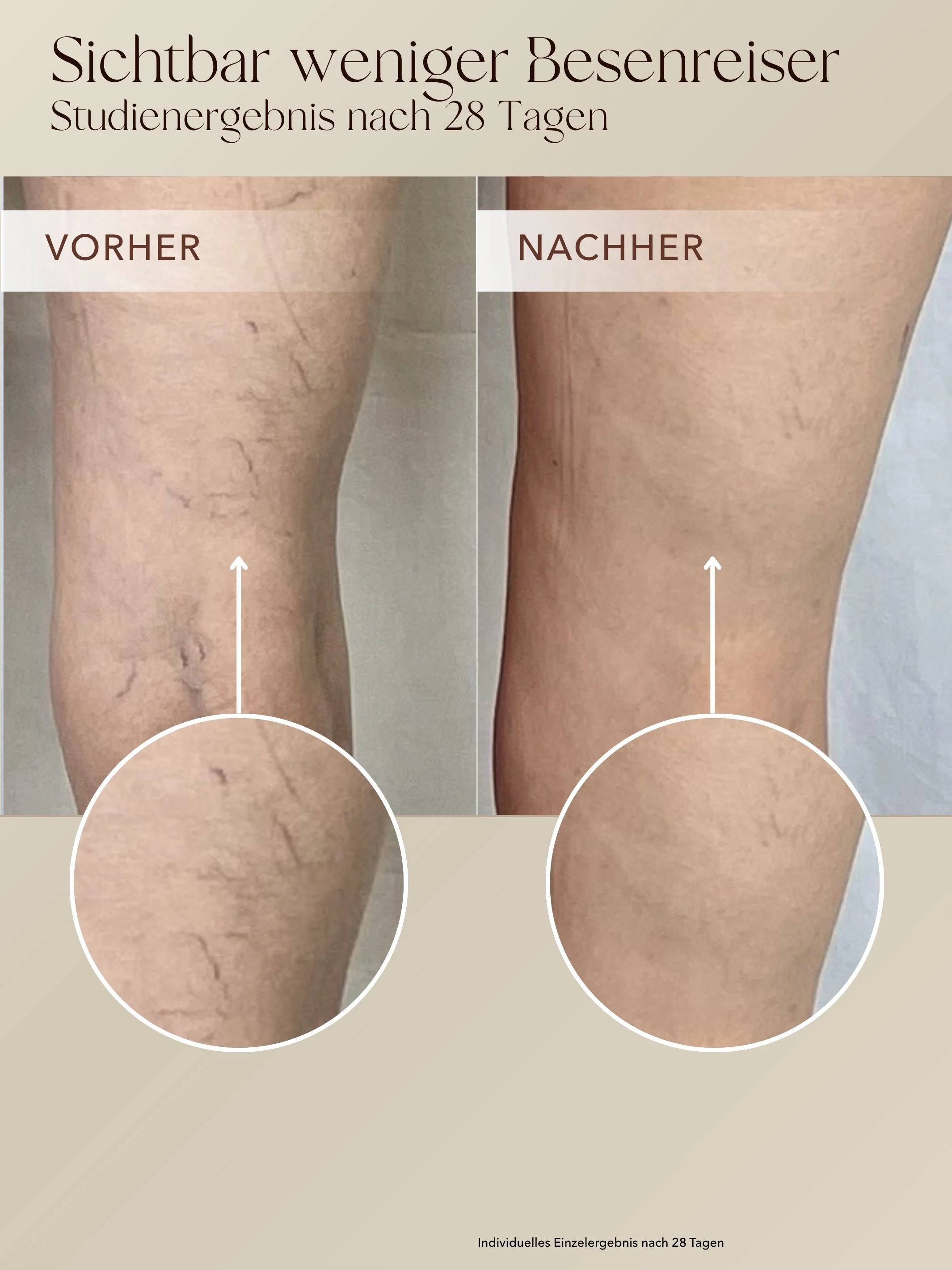 Anti-Cellulite 3-Monats-Kur - Image 7