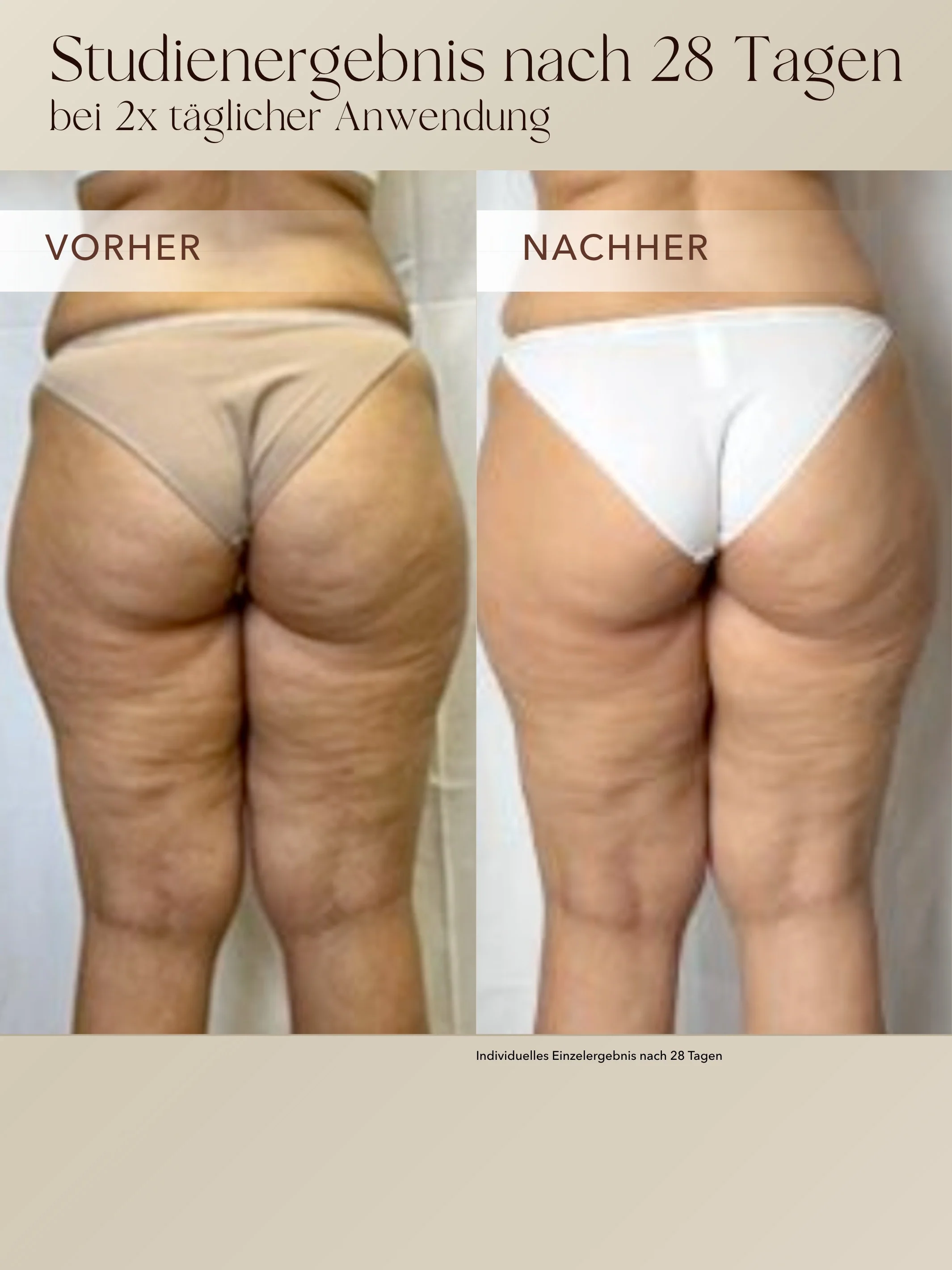 Anti-Cellulite 3-Monats-Kur - Image 3