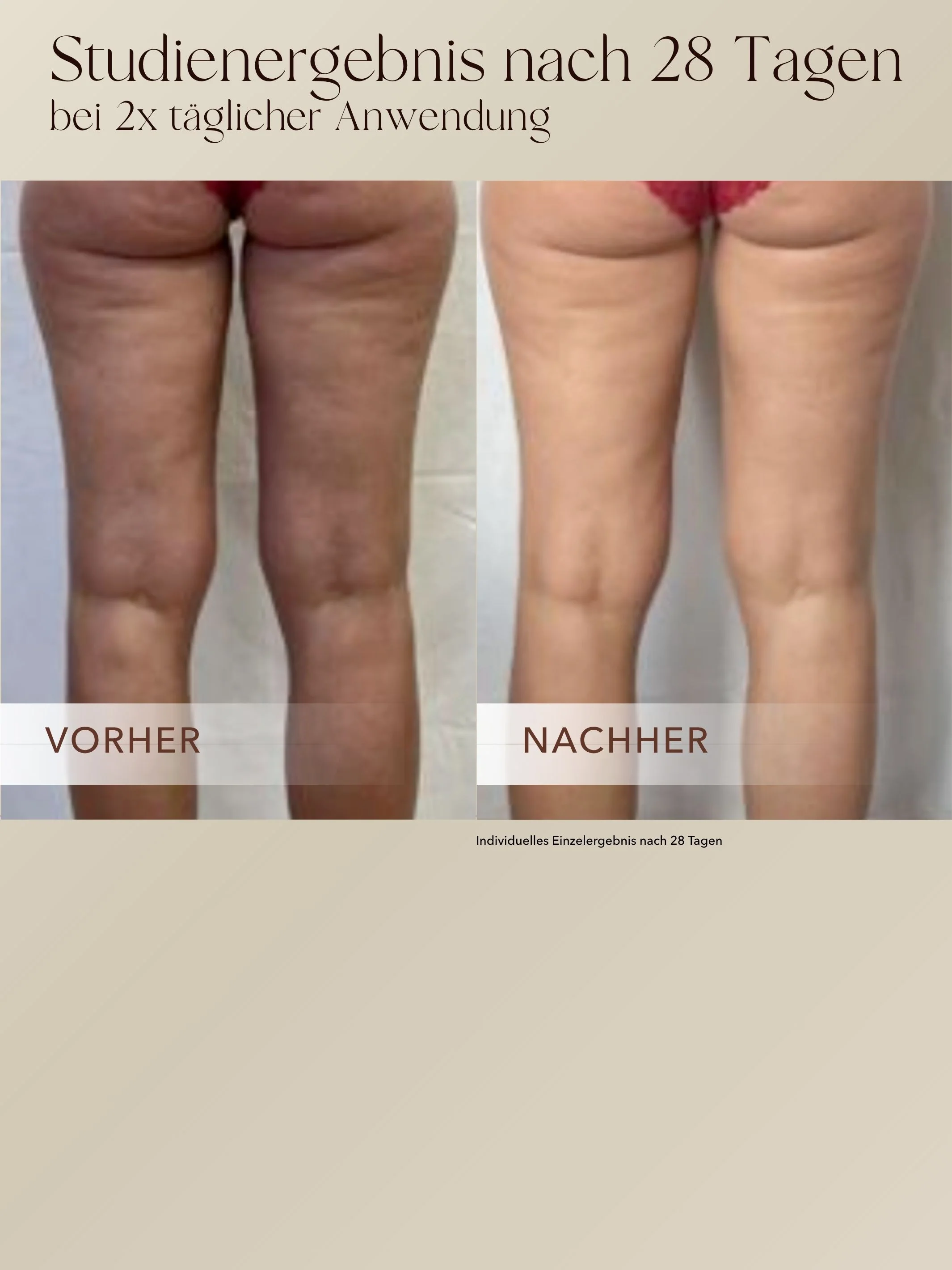 Anti-Cellulite 3-Monats-Kur - Image 6