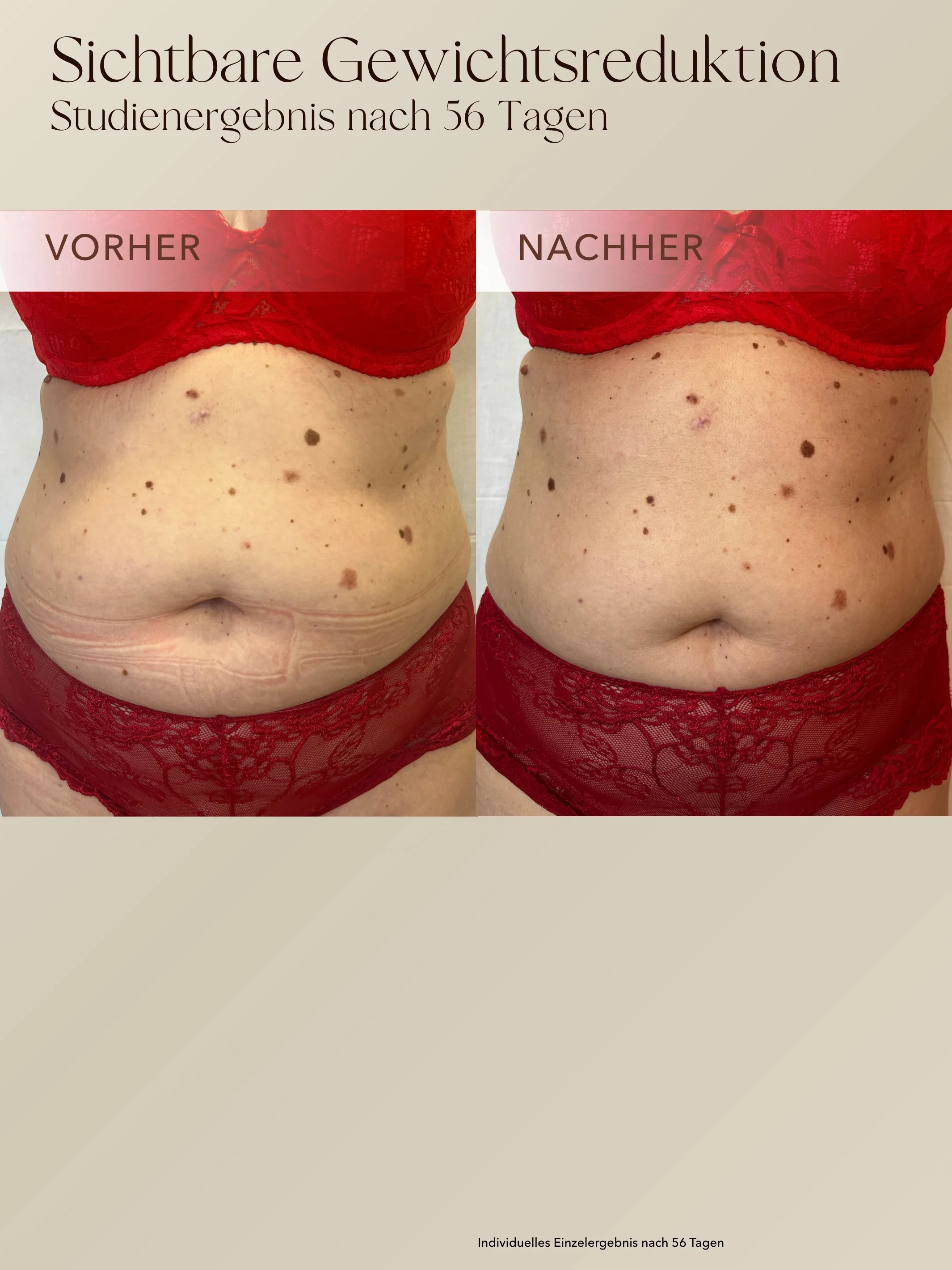 Body Contour Cream - Image 2