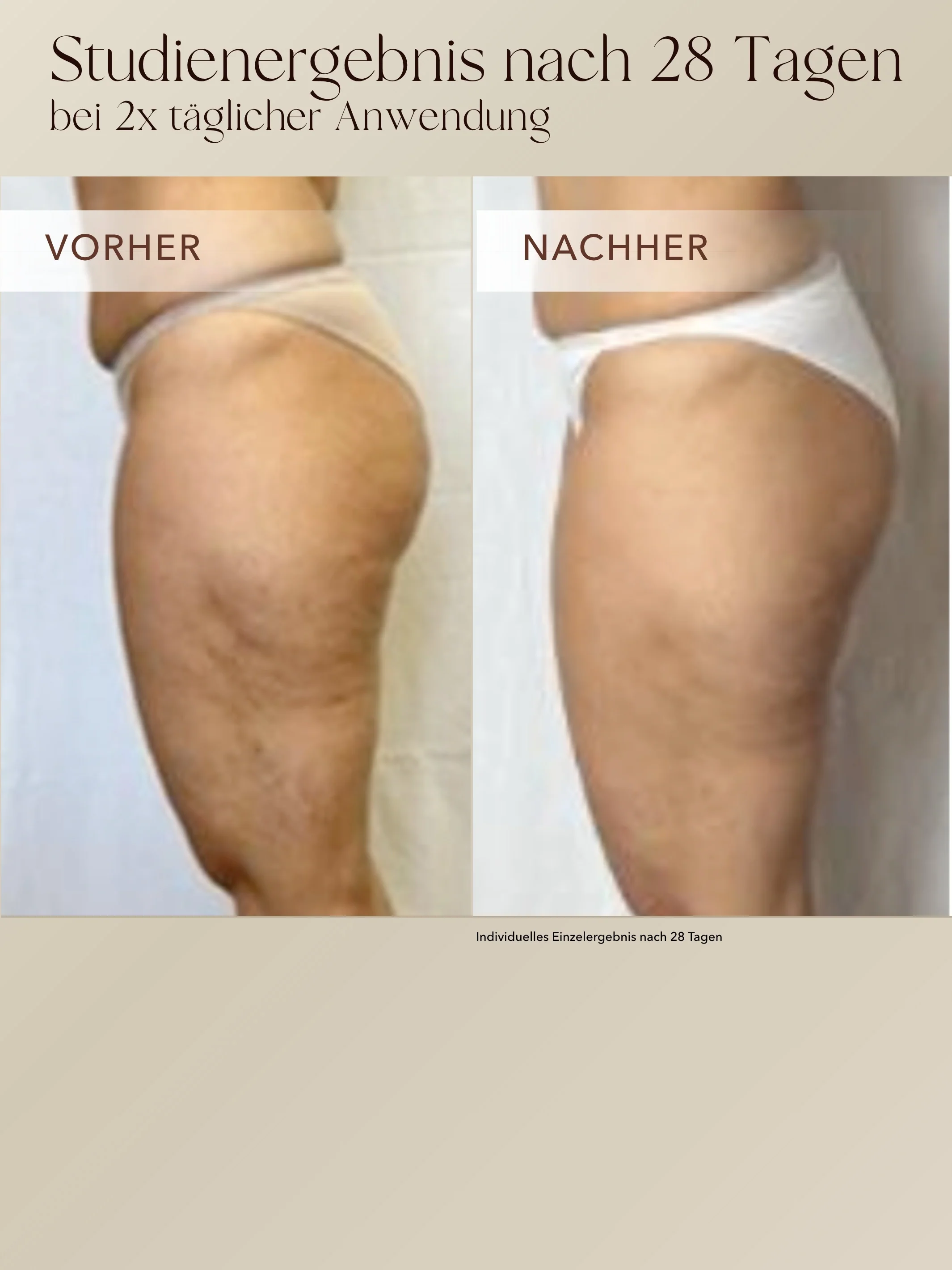 Anti-Cellulite 3-Monats-Kur - Image 5