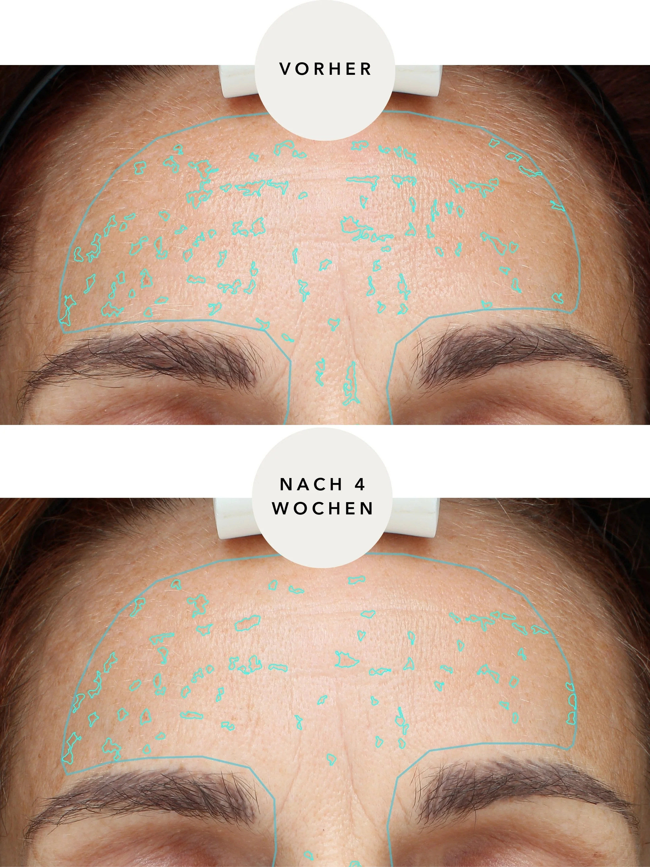 XTREME Brightening Booster - Image 4